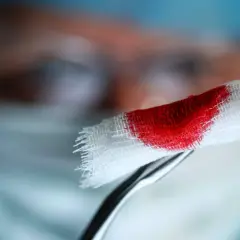 Plamienie implantacyjne kiedy? Delikatne krwawienie na gaziku, które może być wczesnym sygnałem ciąży.