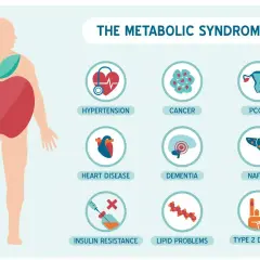 Ilustracja przedstawia zespół metaboliczny, który obejmuje nadciśnienie, choroby serca, oporność na insulinę, raka, demencję, problemy z lipidami, PCOS i cukrzycę typu 2.