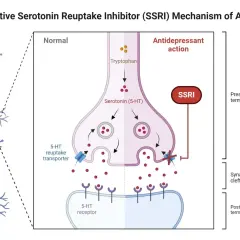 Schemat działania SSRI, np. wenlafaksyny. Blokuje transporter serotoniny, zwiększając jej dostępność w synapsie.