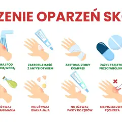 Porady dotyczące leczenia oparzeń skóry: chłodna woda, maść z antybiotykiem, zimny kompres, tabletki przeciwbólowe, sok z aloesu. Unikaj masła, jajka, pasty do zębów, przekłuwania pęcherzy, lodu.