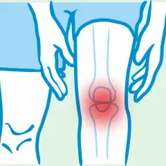 Ilustracja przedstawia ból kolana, który może być objawem spondyloartropatii. Rokowanie zależy od wczesnej diagnozy i leczenia.