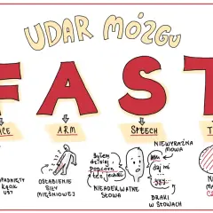 FAST - objawy udaru mózgu u dzieci: opadnięta twarz, osłabienie ręki, niewyraźna mowa, brak czasu.
