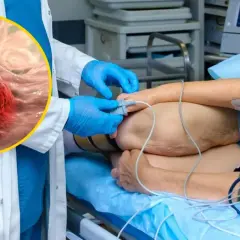 Lekarz w rękawiczkach przygotowuje pacjenta do zabiegu, podczas gdy powiększony obraz pokazuje niebezpieczny gruczolak jelita grubego.