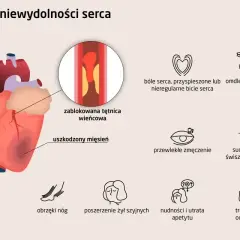 Objawy niewydolności serca: ból serca, omdlenia, zmęczenie, obrzęki nóg, nudności, trudności w oddychaniu i suchy kaszel, który może być objawem kaszlu od serca.