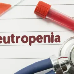 Badanie krwi i stetoskop wskazują na diagnozę neutropenii.