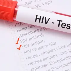 Test HIV z zaznaczonymi pozycjami "HIV antibody" i "HIV antigen". Wczesne objawy HIV u kobiet mogą być subtelne.
