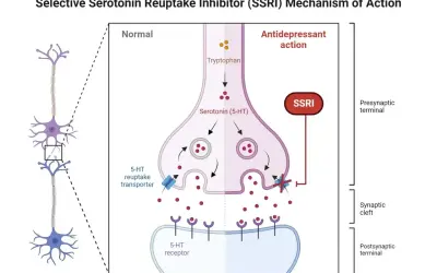 Schemat działania SSRI, np. wenlafaksyny. Blokuje transporter serotoniny, zwiększając jej dostępność w synapsie.