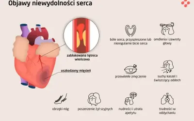 Objawy niewydolności serca: ból serca, omdlenia, zmęczenie, obrzęki nóg, nudności, trudności w oddychaniu i suchy kaszel, który może być objawem kaszlu od serca.