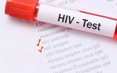 Test HIV z zaznaczonymi pozycjami "HIV antibody" i "HIV antigen". Wczesne objawy HIV u kobiet mogą być subtelne.