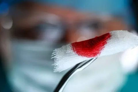 Plamienie implantacyjne kiedy? Delikatne krwawienie na gaziku, które może być wczesnym sygnałem ciąży.