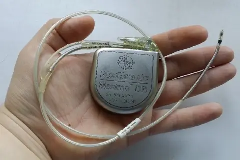 Kardiowerter Medtronic Maximo DR z elektrodami w dłoni.