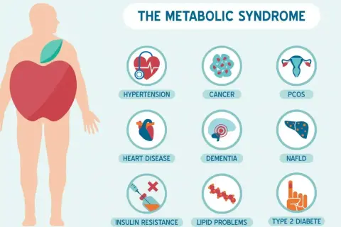 Ilustracja przedstawia zespół metaboliczny, który obejmuje nadciśnienie, choroby serca, oporność na insulinę, raka, demencję, problemy z lipidami, PCOS i cukrzycę typu 2.