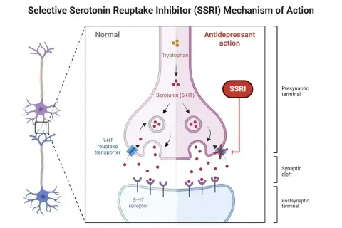 Schemat działania SSRI, np. wenlafaksyny. Blokuje transporter serotoniny, zwiększając jej dostępność w synapsie.