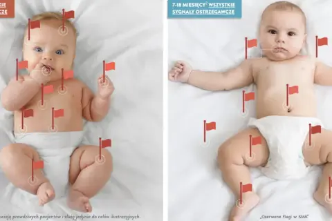 Dwa niemowlęta z czerwonymi flagami oznaczającymi sygnały ostrzegawcze w SMA. Jedno ma 0-6 miesięcy, drugie 7-18 miesięcy.