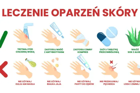 Porady dotyczące leczenia oparzeń skóry: chłodna woda, maść z antybiotykiem, zimny kompres, tabletki przeciwbólowe, sok z aloesu. Unikaj masła, jajka, pasty do zębów, przekłuwania pęcherzy, lodu.