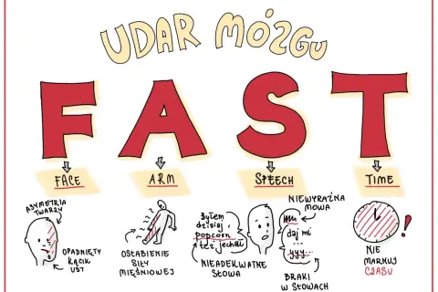 FAST - objawy udaru mózgu u dzieci: opadnięta twarz, osłabienie ręki, niewyraźna mowa, brak czasu.
