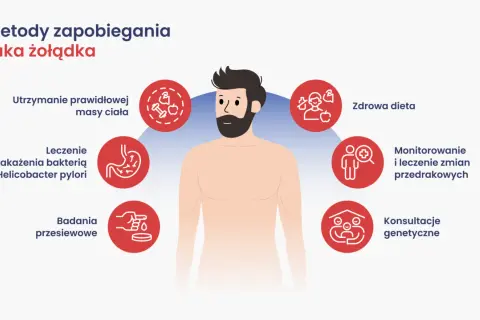Metody zapobiegania raka żołądka: zdrowa dieta, kontrola masy ciała, leczenie H. pylori, badania przesiewowe, monitorowanie zmian, konsultacje genetyczne.