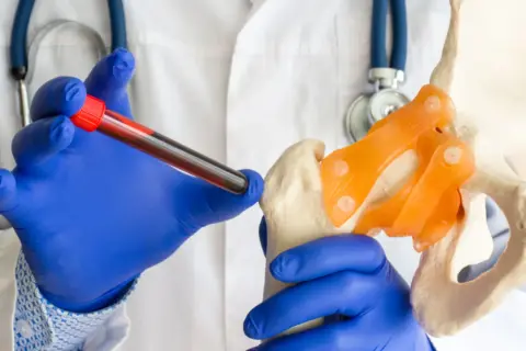 Lekarz w niebieskich rękawiczkach trzyma probówkę z krwią obok modelu miednicy, symbolizując diagnostykę raka szpiku kostnego.