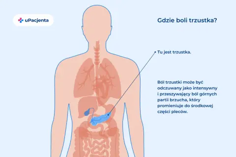 Ilustracja przedstawia lokalizację trzustki w ludzkim ciele. Ból trzustki może być intensywny i promieniować do pleców.