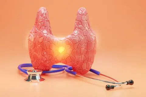 Model tarczycy z widocznym ogniskiem zapalnym, sugerującym raka rdzeniastego tarczycy. Obok leży stetoskop, symbol diagnostyki medycznej.