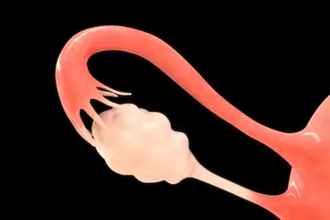 Anatomia jajnika: szczegółowy widok budowy jajnika z przylegającą jajowodem.