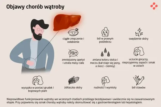 Ilustracja przedstawia objawy chorób wątroby, takie jak zmęczenie, ból, swędzenie skóry, zmiany apetytu, żółtaczka, nudności, gorzki smak w ustach, wysypka i ból stawów.