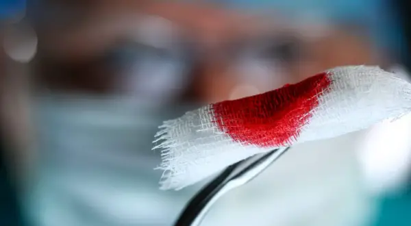 Plamienie implantacyjne kiedy? Delikatne krwawienie na gaziku, które może być wczesnym sygnałem ciąży.