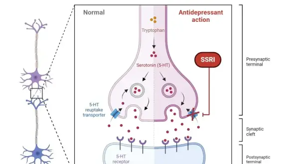 Schemat działania SSRI, np. wenlafaksyny. Blokuje transporter serotoniny, zwiększając jej dostępność w synapsie.