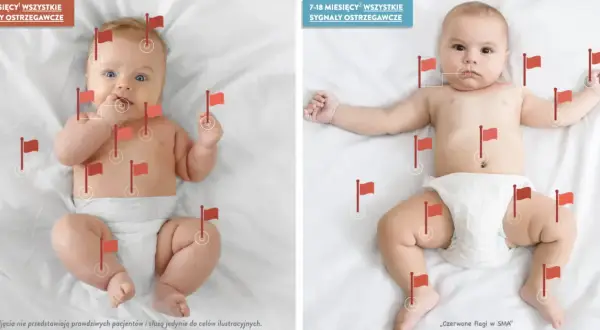 Dwa niemowlęta z czerwonymi flagami oznaczającymi sygnały ostrzegawcze w SMA. Jedno ma 0-6 miesięcy, drugie 7-18 miesięcy.