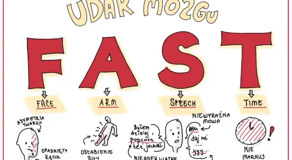 FAST - objawy udaru mózgu u dzieci: opadnięta twarz, osłabienie ręki, niewyraźna mowa, brak czasu.