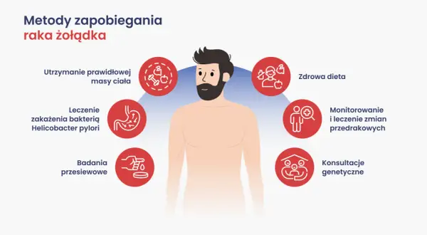 Metody zapobiegania raka żołądka: zdrowa dieta, kontrola masy ciała, leczenie H. pylori, badania przesiewowe, monitorowanie zmian, konsultacje genetyczne.