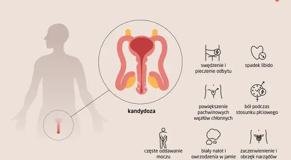 Objawy kandydozy u mężczyzn: pieczenie, spadek libido, ból podczas stosunku, zaczerwienienie narządów płciowych.
