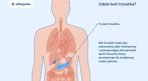 Ilustracja przedstawia lokalizację trzustki w ludzkim ciele. Ból trzustki może być intensywny i promieniować do pleców.