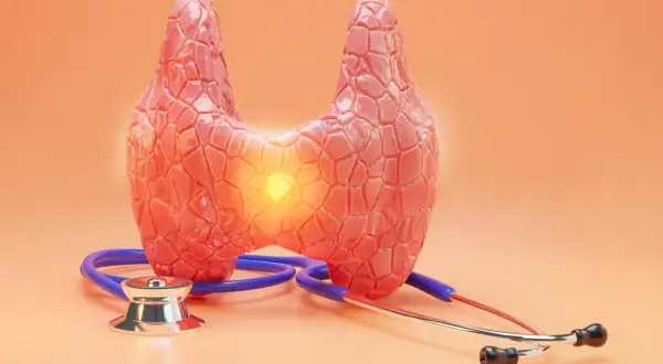 Model tarczycy z widocznym ogniskiem zapalnym, sugerującym raka rdzeniastego tarczycy. Obok leży stetoskop, symbol diagnostyki medycznej.