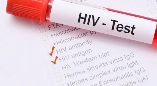 Test HIV z zaznaczonymi pozycjami "HIV antibody" i "HIV antigen". Wczesne objawy HIV u kobiet mogą być subtelne.
