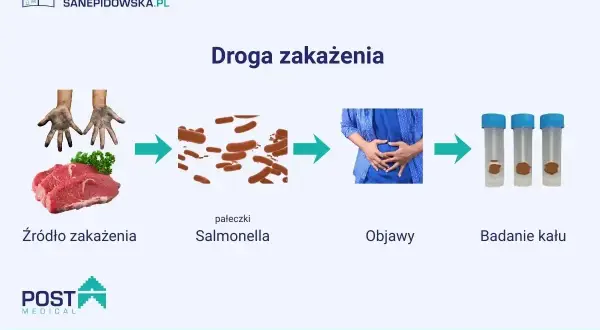 Droga zakażenia salmonellą: surowe mięso, pałeczki, objawy bólu brzucha, badanie kału. Ważne dla zdrowia dzieci.