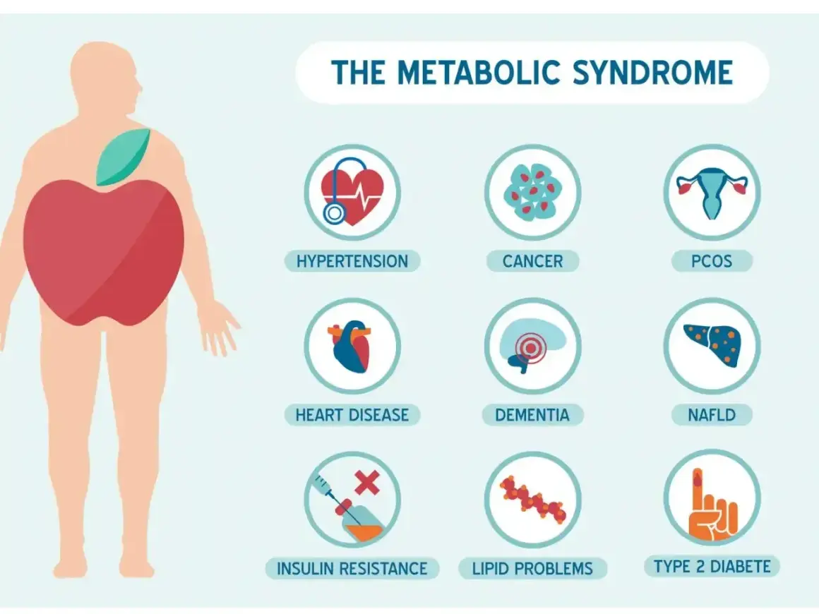 Ilustracja przedstawia zespół metaboliczny, który obejmuje nadciśnienie, choroby serca, oporność na insulinę, raka, demencję, problemy z lipidami, PCOS i cukrzycę typu 2.