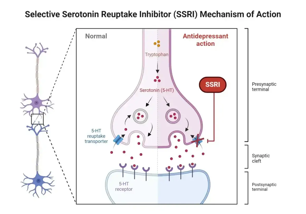 Schemat działania SSRI, np. wenlafaksyny. Blokuje transporter serotoniny, zwiększając jej dostępność w synapsie.