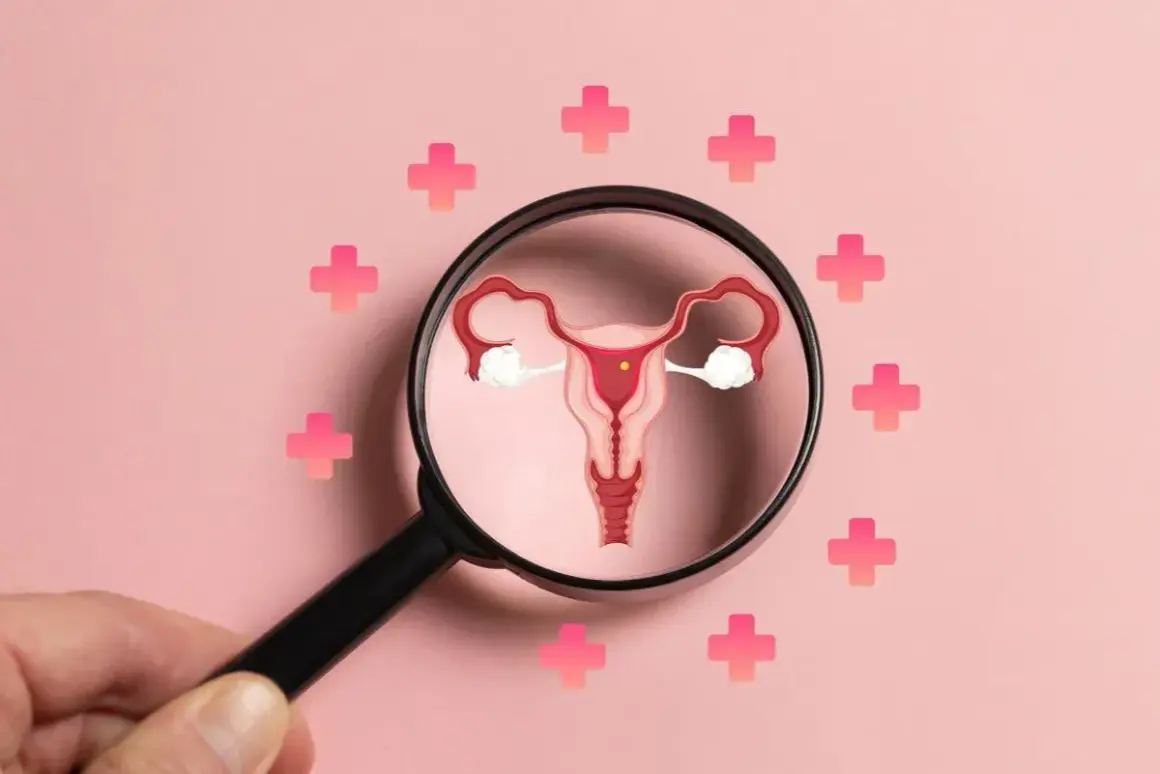 PCOS co to? Ilustracja narządów rodnych pod lupą, otoczona różowymi krzyżykami symbolizującymi zdrowie.