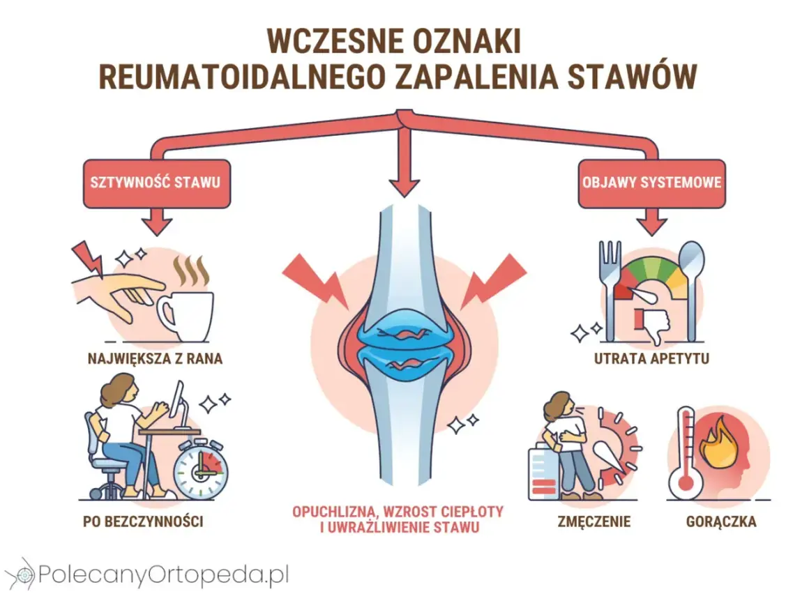 Wczesne oznaki reumatoidalnego zapalenia stawów: sztywność, opuchlizna, zmęczenie, gorączka, utrata apetytu. Stan zapalny w organizmie objawia się na różne sposoby.