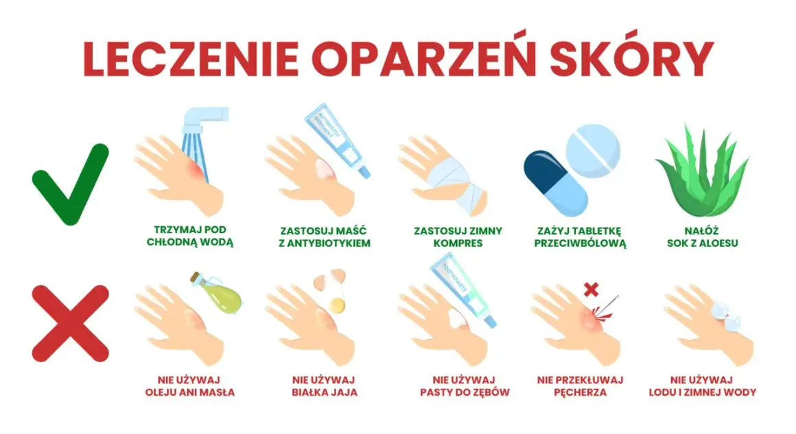 Porady dotyczące leczenia oparzeń skóry: chłodna woda, maść z antybiotykiem, zimny kompres, tabletki przeciwbólowe, sok z aloesu. Unikaj masła, jajka, pasty do zębów, przekłuwania pęcherzy, lodu.