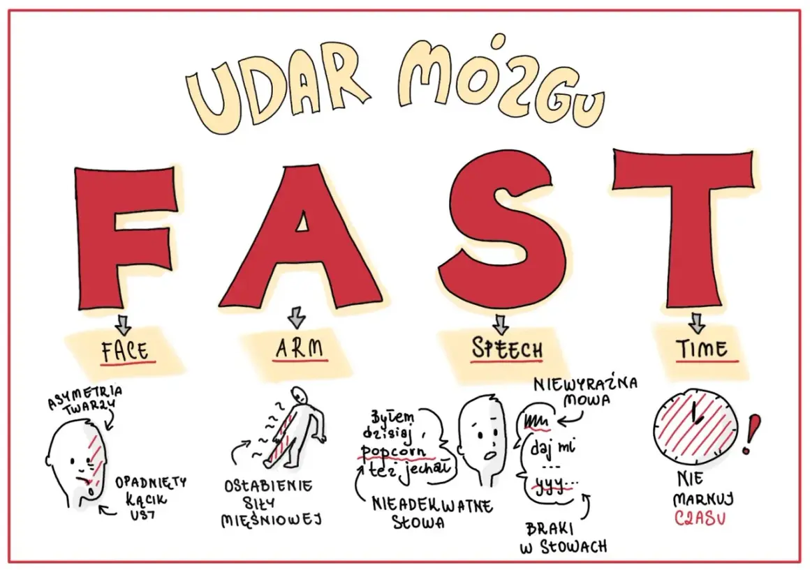 FAST - objawy udaru mózgu u dzieci: opadnięta twarz, osłabienie ręki, niewyraźna mowa, brak czasu.