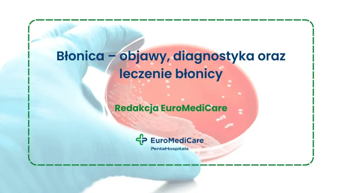 Błonica – objawy, diagnostyka i leczenie. Badanie laboratoryjne potwierdzające dyfteryt.