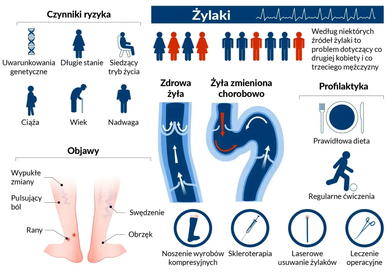 Grafika ilustruje czynniki ryzyka, objawy i profilaktykę żylaków, podkreślając, że przewlekła niewydolność żylna dotyka wiele osób.