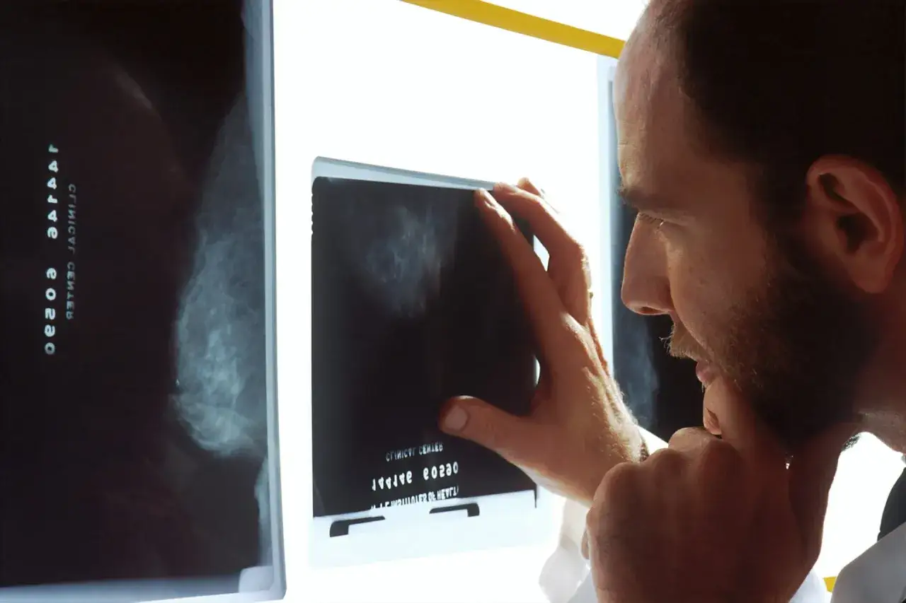 Lekarz analizuje mammografię, szukając oznak nowotworu.