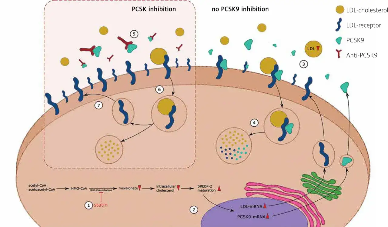 Schemat przedstawia działanie inklisiranu, blokującego PCSK9, co zwiększa liczbę receptorów LDL i obniża cholesterol.