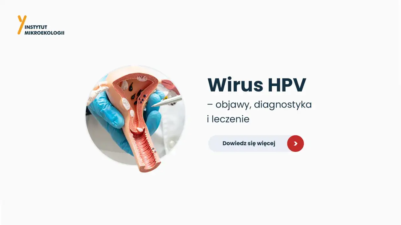 Model narządów rodnych z widocznymi zmianami, sugerującymi infekcję wirusem brodawczaka ludzkiego (HPV). Informacje o objawach, diagnostyce i leczeniu.