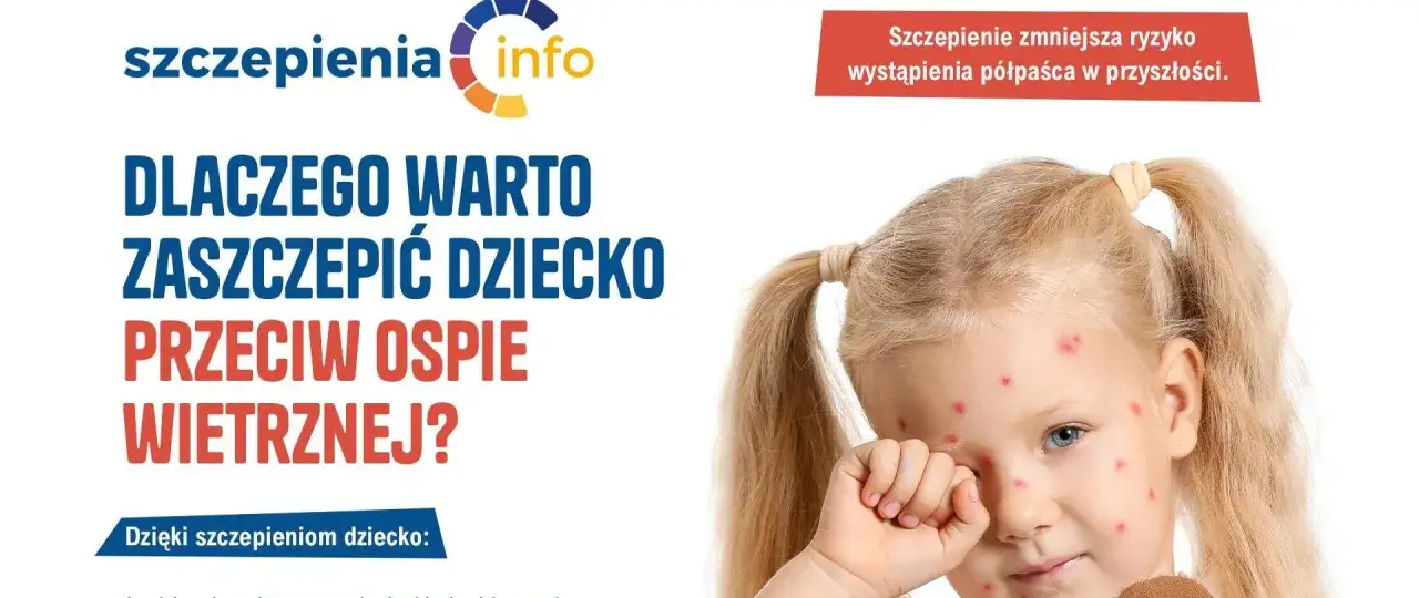 Dziewczynka z ospą wietrzną, której szczepienie przeciwko tej chorobie, jak i przeciwko półpaścowi (varilrix), jest zalecane.