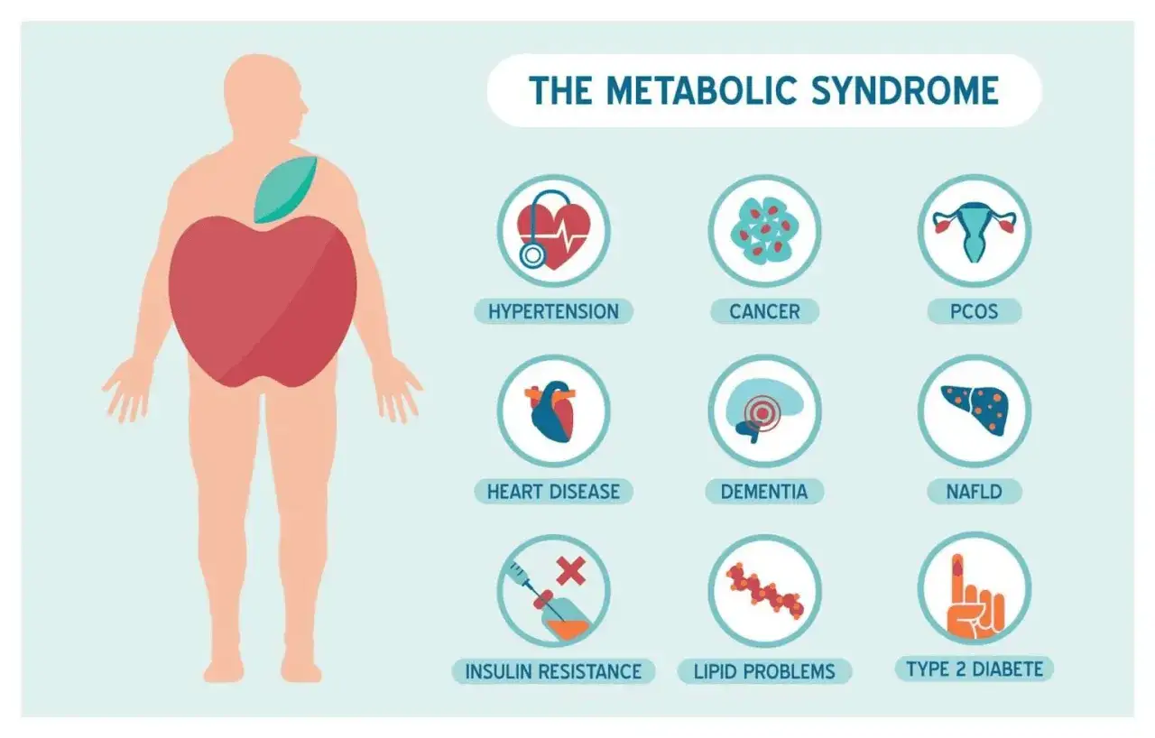 Ilustracja przedstawia zespół metaboliczny i jego powiązane zaburzenia: nadciśnienie, raka, PCOS, choroby serca, demencję, NAFLD, insulinooporność, problemy z lipidami i cukrzycę typu 2.