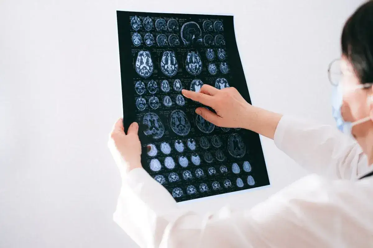 Lekarz analizuje rezonans magnetyczny mózgu, zastanawiając się, ile zarabia neurolog.